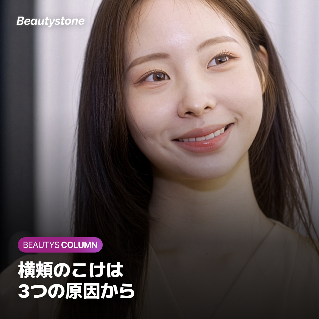 横頬がこけて見える3つの原因、脂肪の減少・骨格・たるみ