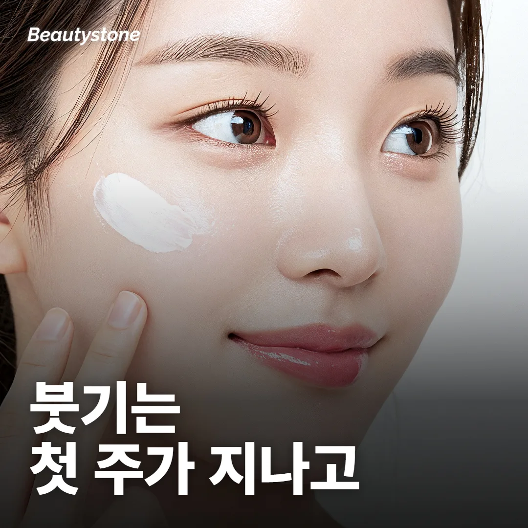 입술필러 붓기 며칠 가요?