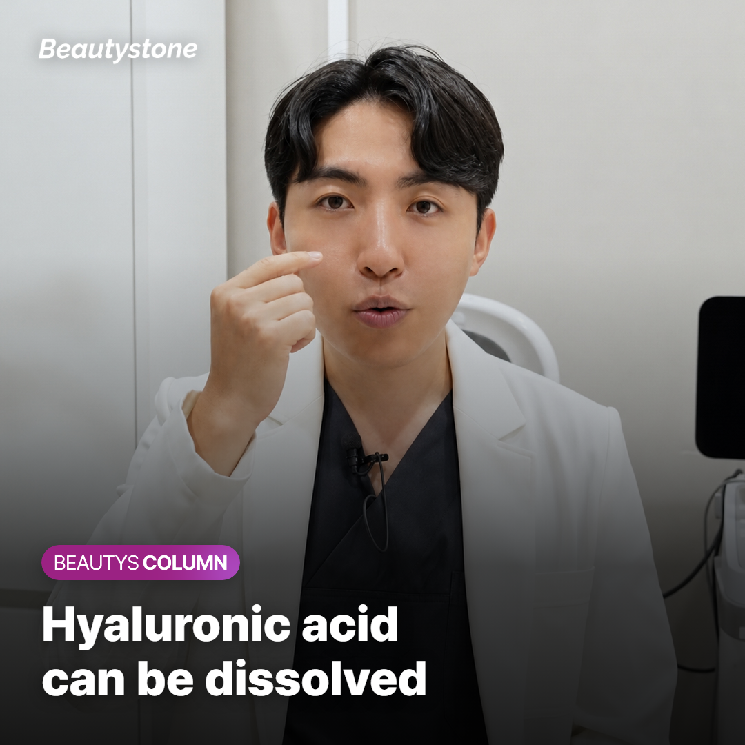 Hyaluronic acid filler that can be dissolved with hyaluronidase