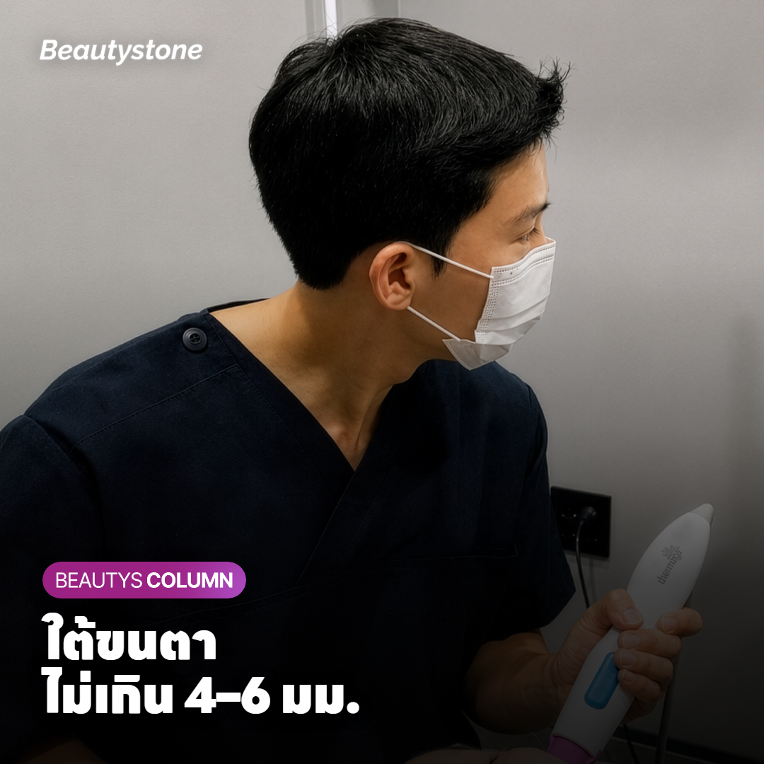 เกณฑ์ฉีดฟิลเลอร์ถุงยิ้มภายใน 4–6 มม. ใต้ขนตา