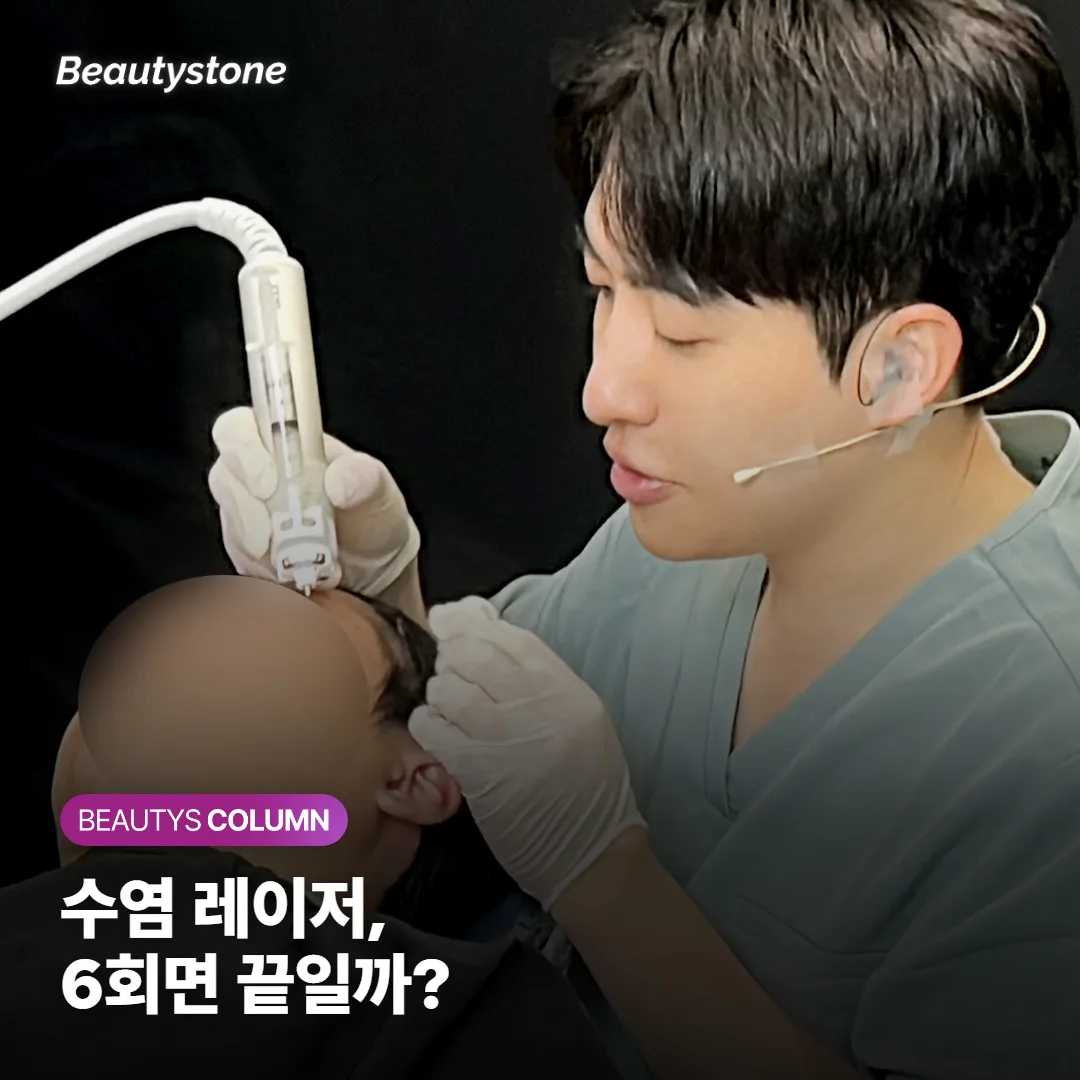 수염 레이저 제모, 6회면 끝일까? 왁싱과 다른 유지 기간