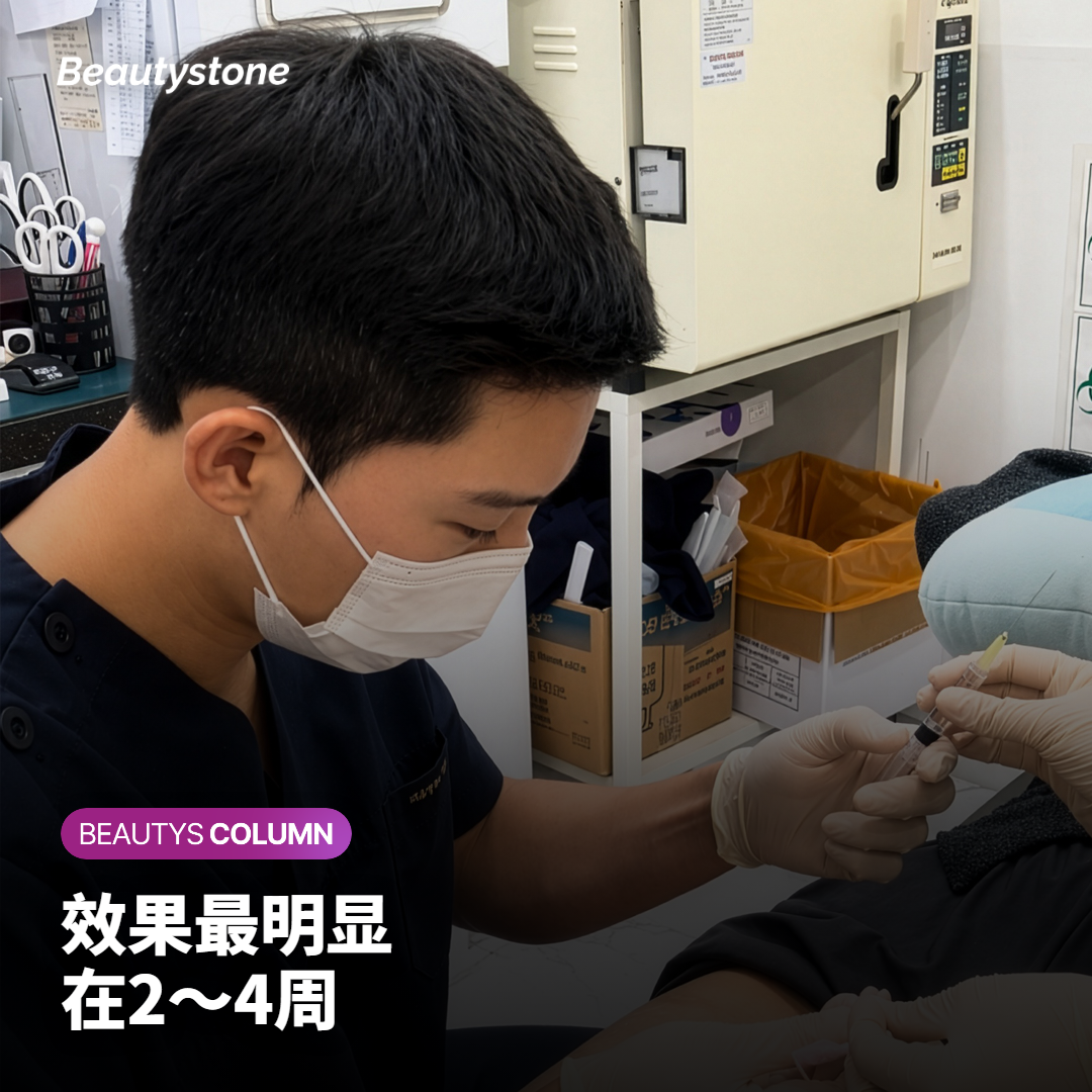 肉毒素注射后2～4周牙龈露出减少，约6个月内逐渐消退
