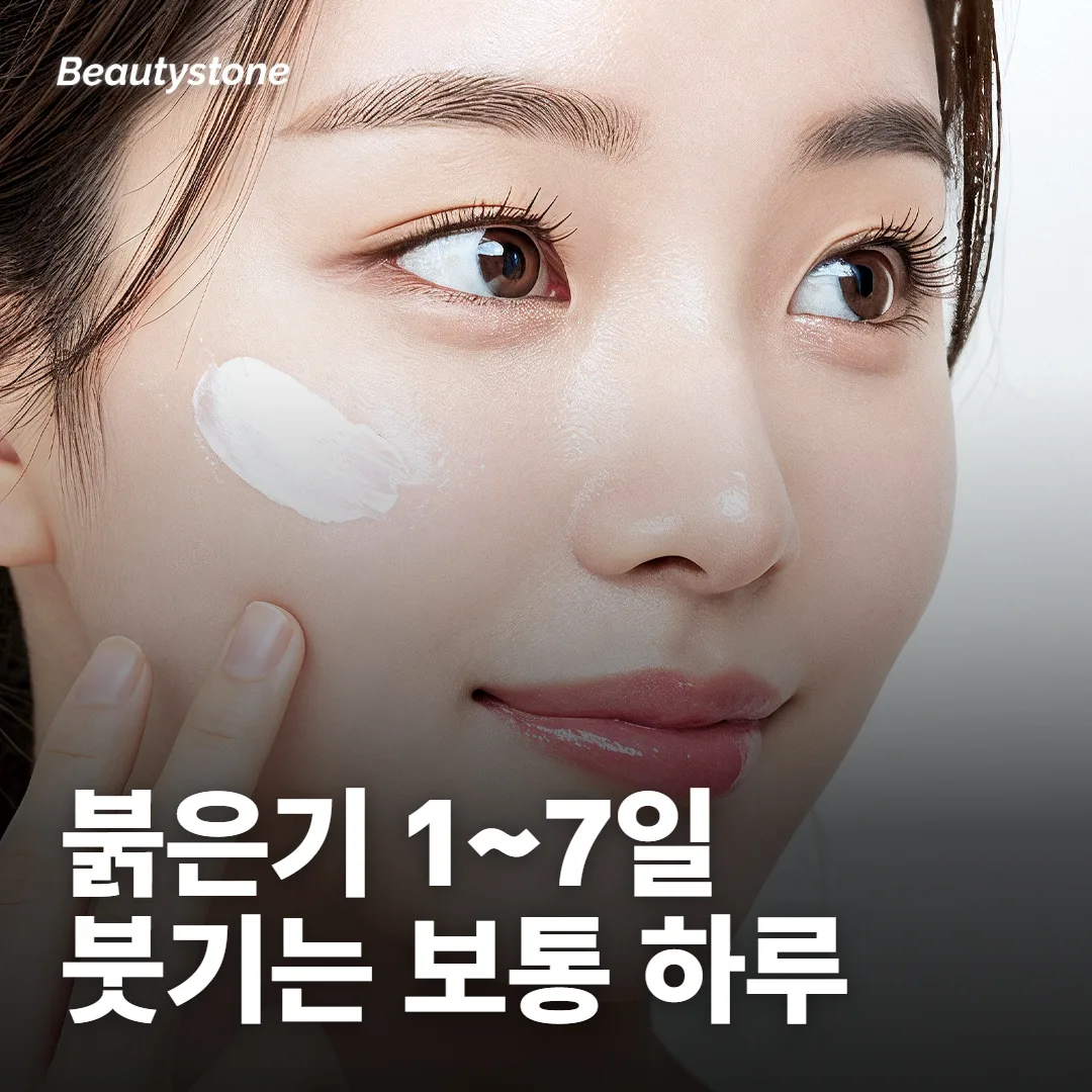 포텐자 다운타임 얼마나 가요?