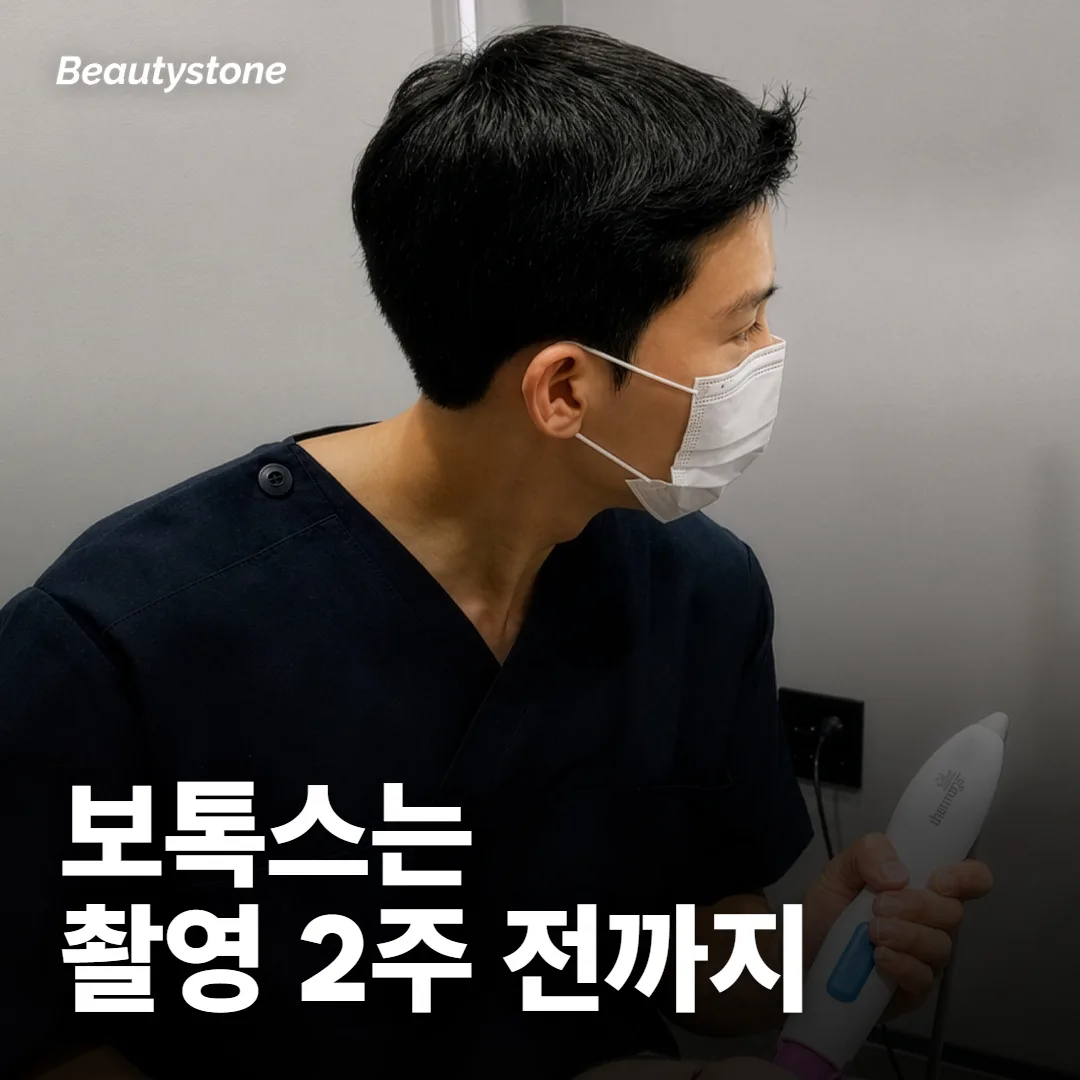 웨딩촬영 전에 보톡스는 언제 맞아요?