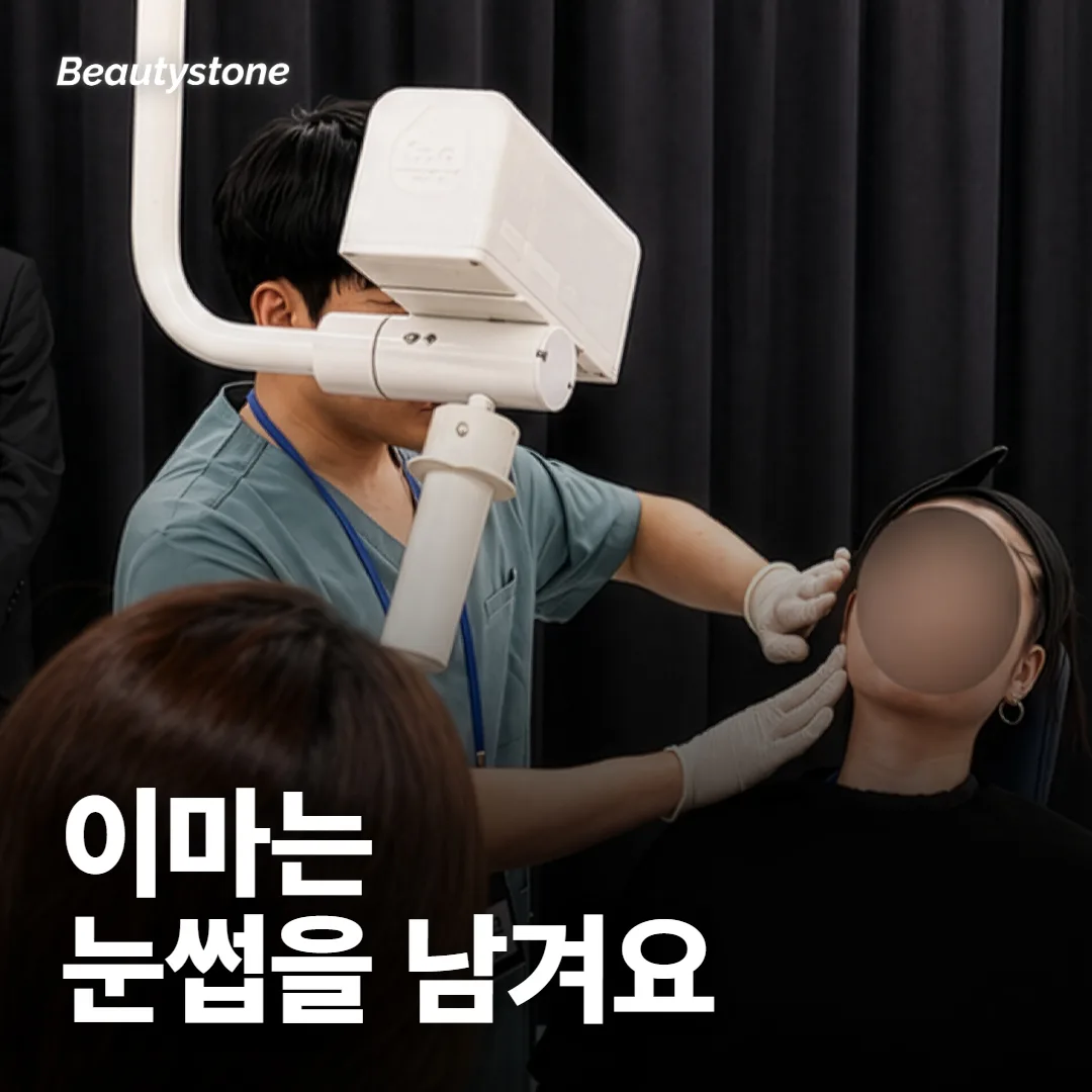 이마 보톡스 맞으면 표정이 어색해지지 않아요?