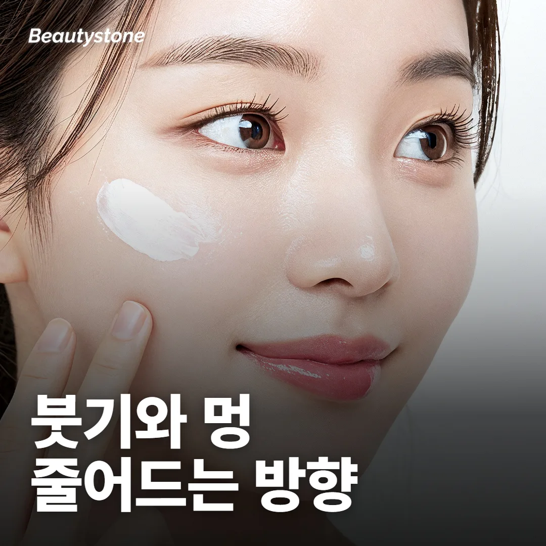 골반필러 붓기와 멍, 자리 잡는 기간은요?