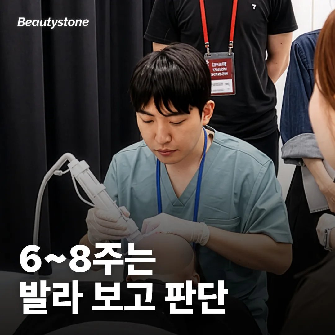 바르는 약은 몇 주 뒤에 판단할까요