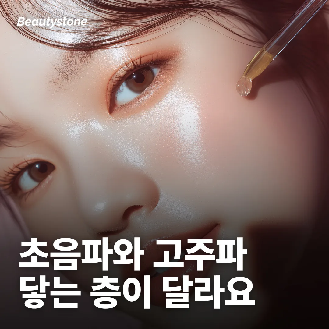 초음파 리프팅이랑 고주파 리프팅, 뭐가 달라요?