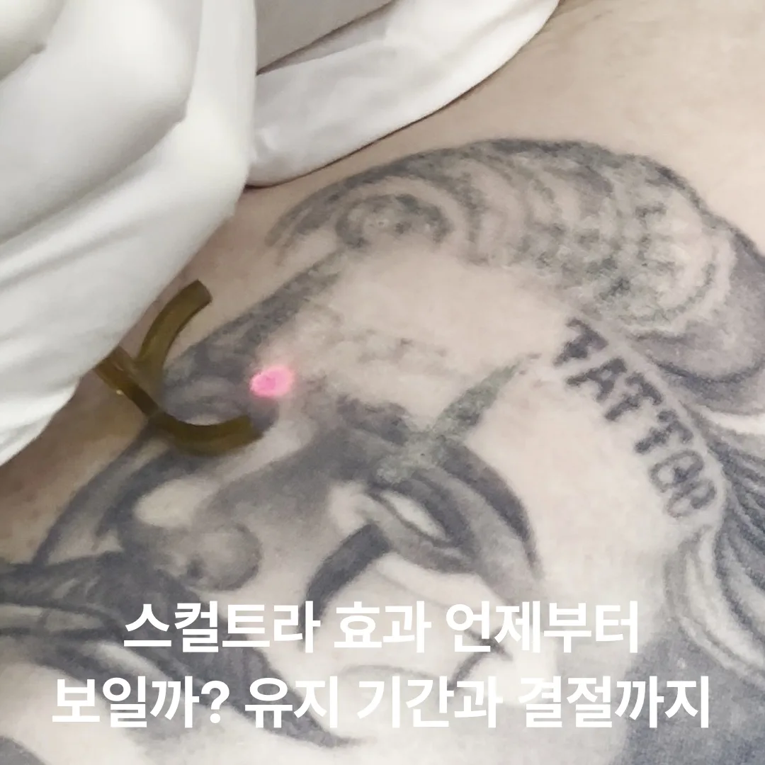 스컬트라 효과 언제부터 보일까? 유지 기간과 결절*까지