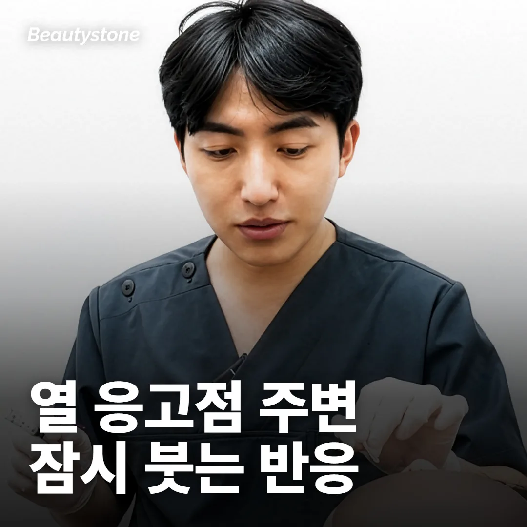 슈링크 붓기는 며칠에서 2주 사이에 줄어드는 흐름으로 봐요