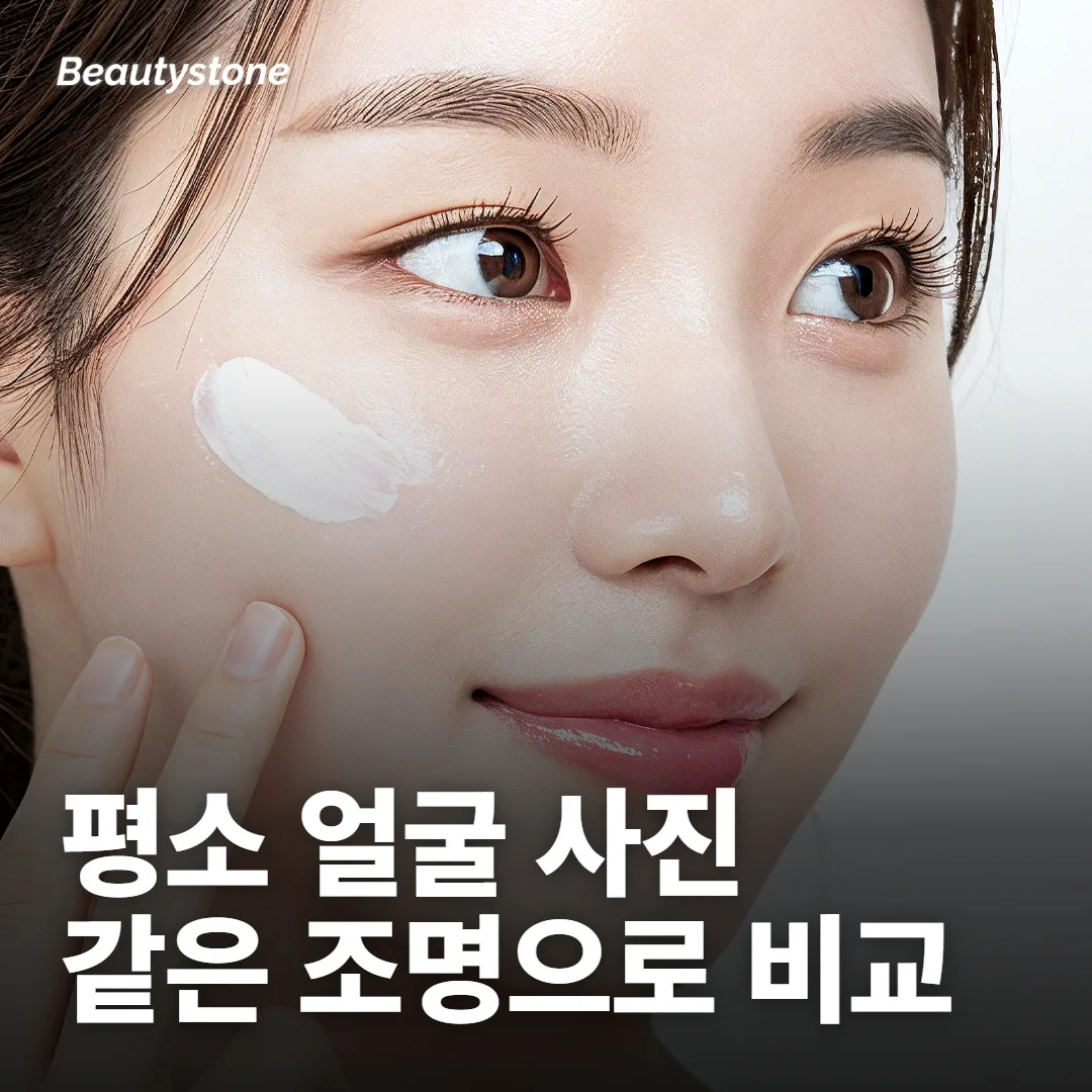평소 얼굴을 기록해 두면 두 붓기가 갈려요