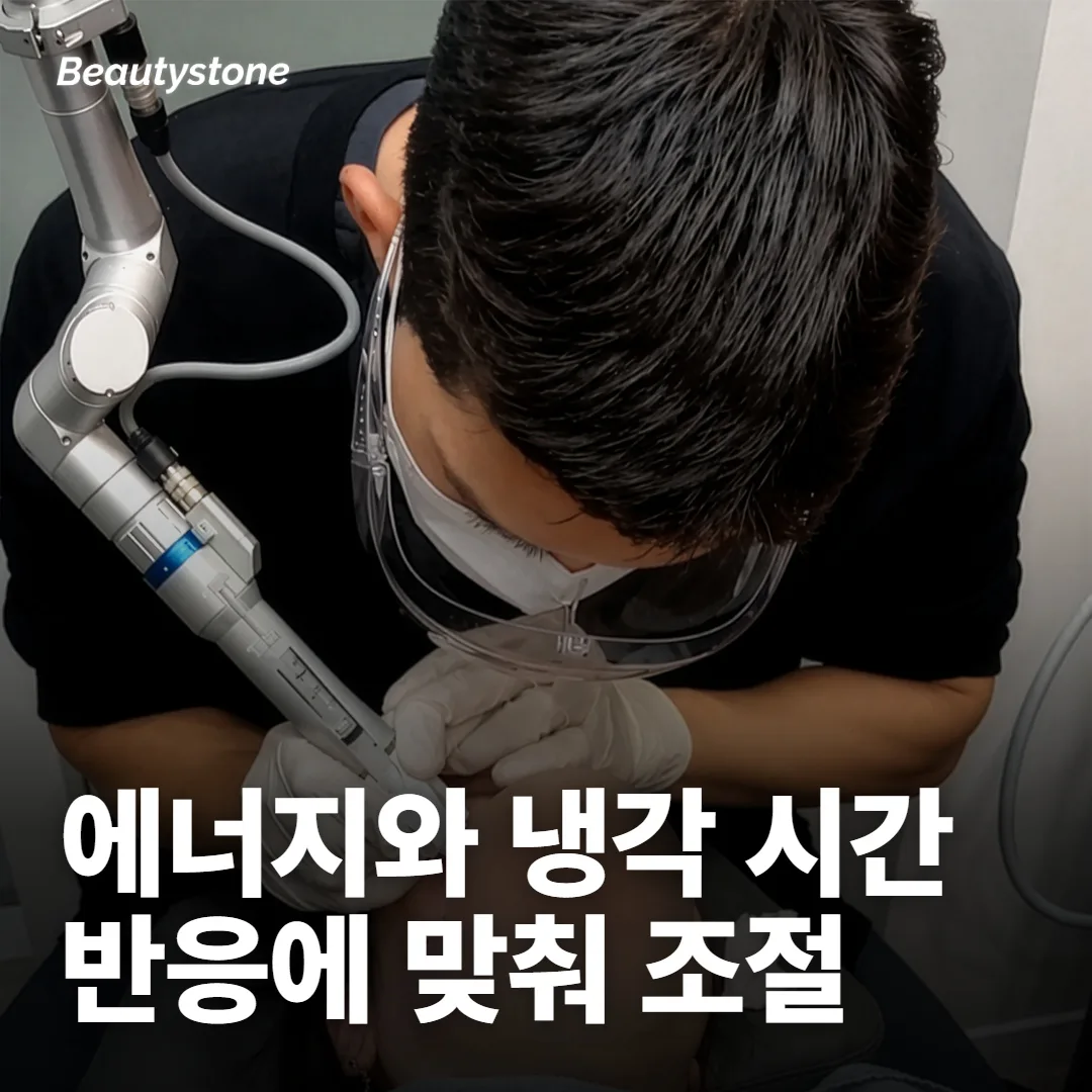 시술 중 무엇을 조절할 수 있나요?
