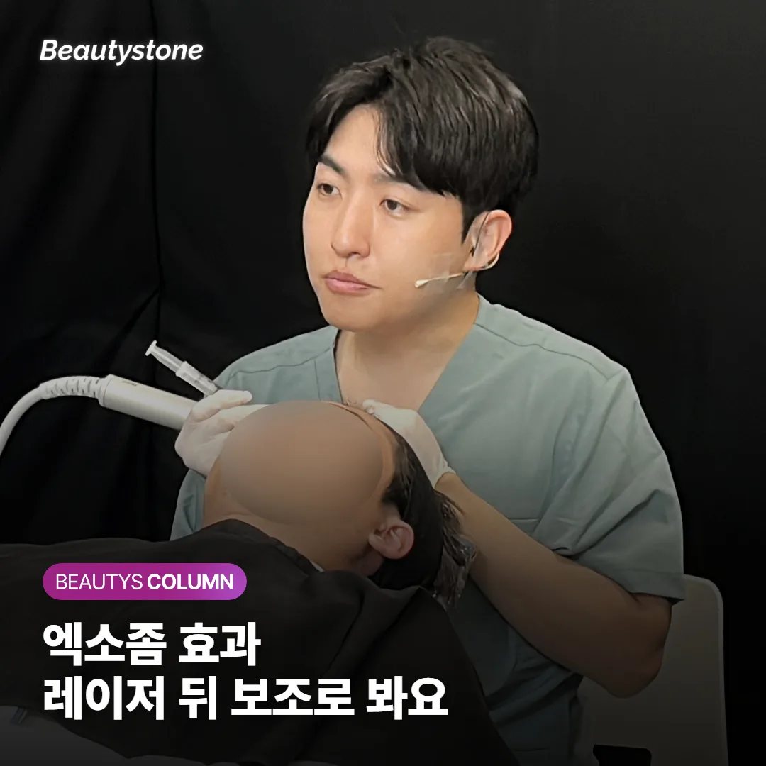 엑소좀 효과, 주사 단독보다 레이저 뒤 보조로 볼까요?