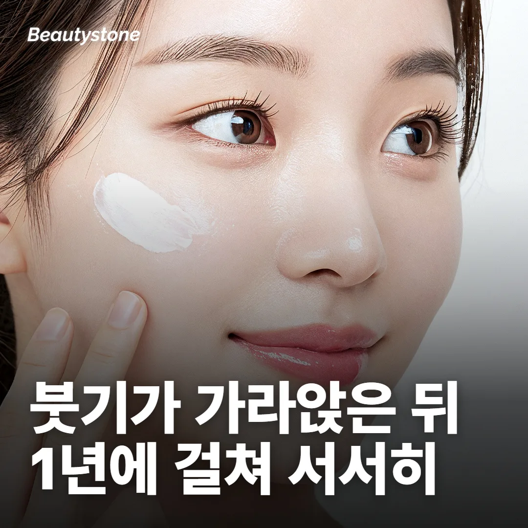 효과는 붓기가 가라앉은 뒤 보고, 1년에 걸쳐 서서히 줄어요
