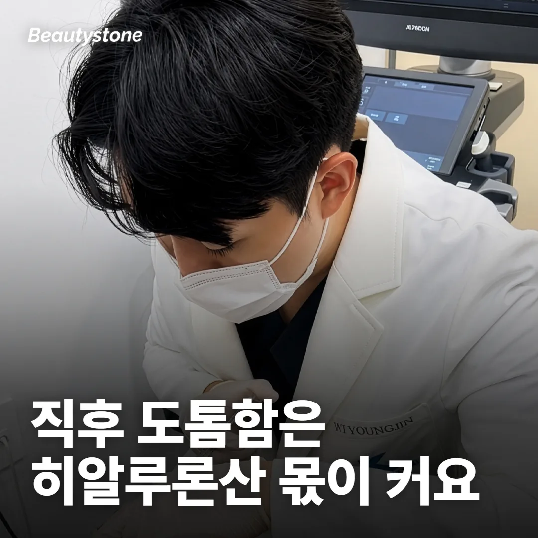쥬베룩 직후 사진에는 히알루론산 볼륨이 섞여 있어요