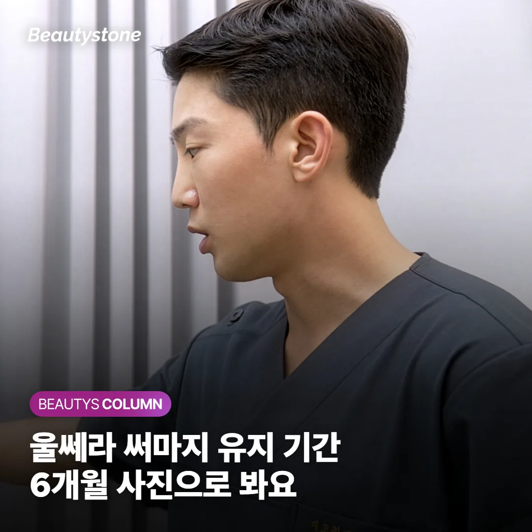 울쎄라 써마지 유지 기간, 더 오래가는 쪽보다 6개월 사진으로 볼까요?