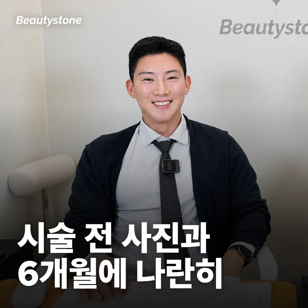 6개월 무렵, 시술 전 사진과 나란히 놓고 정해요