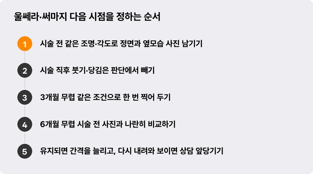 울쎄라·써마지 다음 시점을 정하는 순서