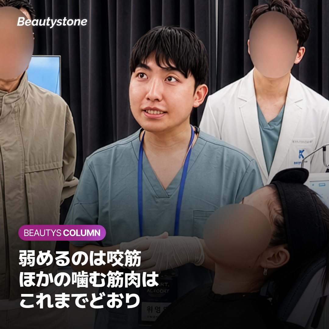 エラボトックスで噛む力は落ちる？弱めるのは咬筋の力です