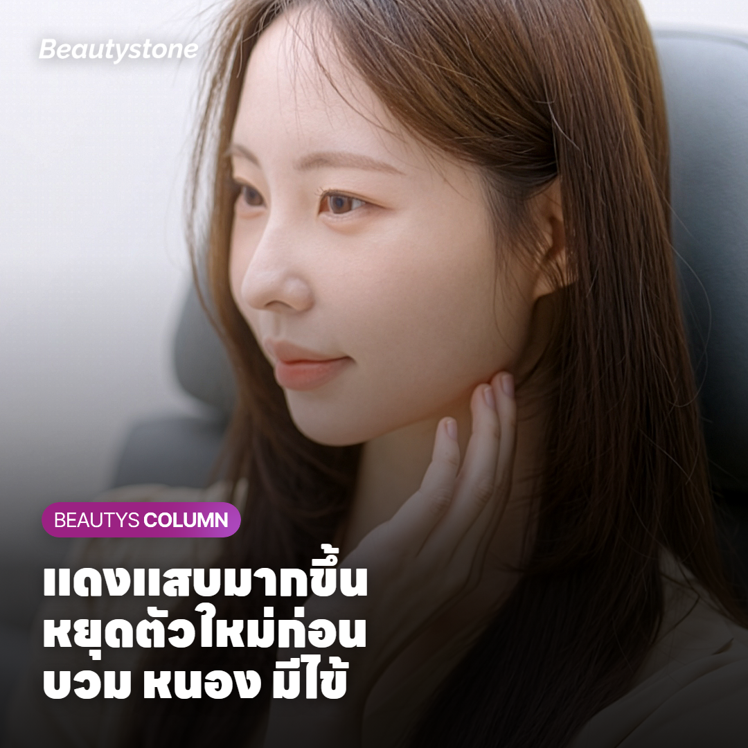 ผลข้างเคียงและข้อควรระวัง: ทาแล้วผิวมีปฏิกิริยา เมื่อไรควรหยุดและไปพบแพทย์
