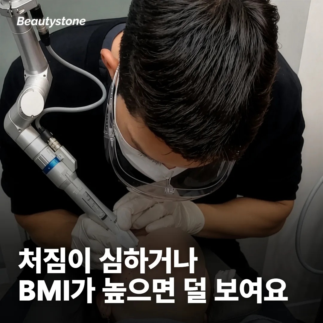 덜 달라지는 쪽은 처짐이 심하거나 BMI가 높은 얼굴이에요