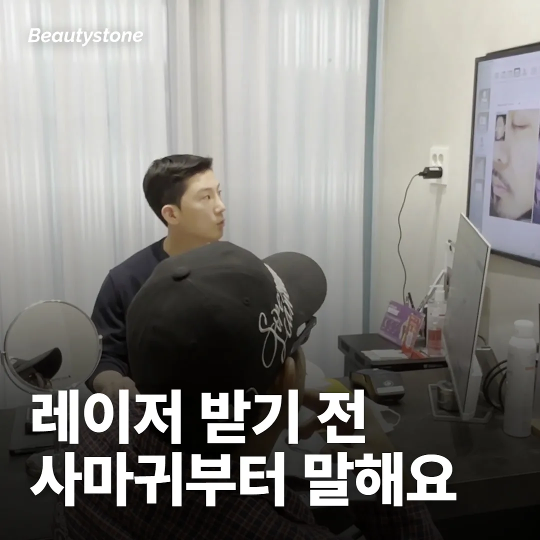 레이저나 박피 전에 사마귀부터 말해야 하는 이유