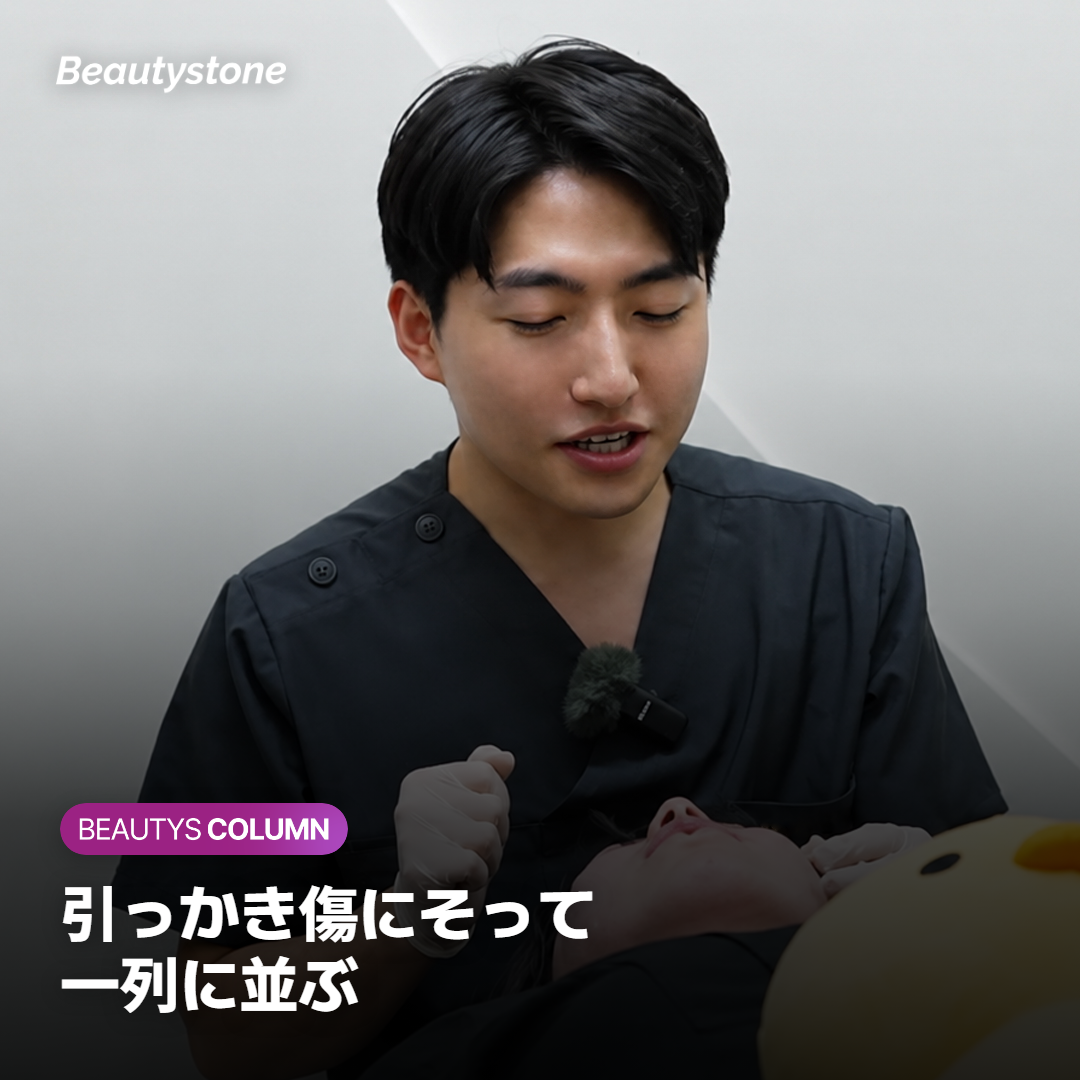 引っかき傷にそって一列に並んだ小さな扁平イボ