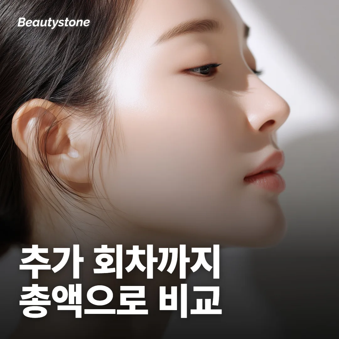 두 곳의 견적을 나란히 놓을 때 마지막으로 무엇을 맞추면 될까요?