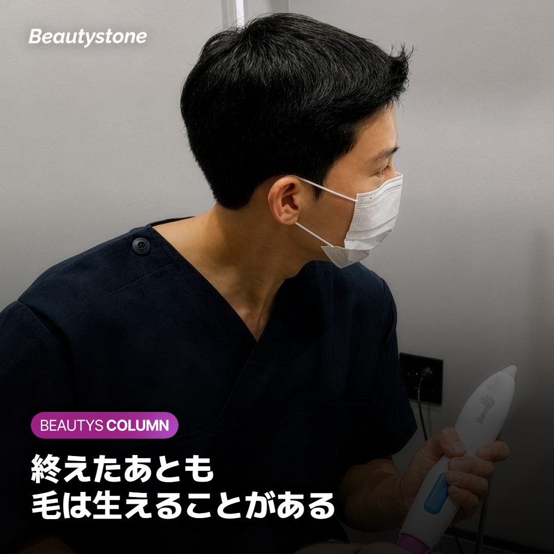 皮膚の断面で毛の色素にレーザーの光が届き、毛包が熱を受ける様子を示した図