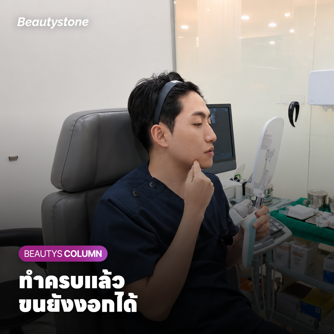 ภาพตัดขวางผิวแสดงแสงเลเซอร์ส่งความร้อนไปที่รูขุมขน และเส้นขนเล็ก ๆ ที่งอกกลับมา