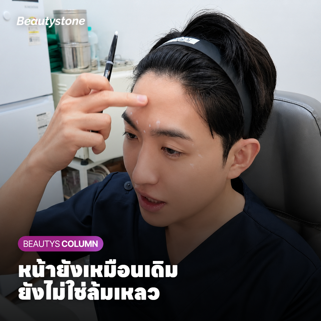แผนภาพชั้นผิวที่เลเซอร์สามความยาวคลื่นส่งความร้อนลงไปอุ่นชั้นหนังแท้