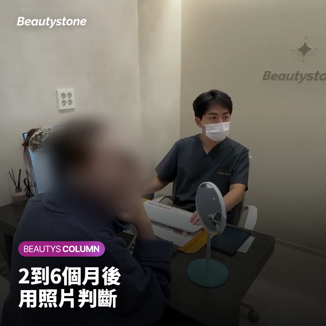 在相同光線與角度下拍攝的臉部側面輪廓比較照片