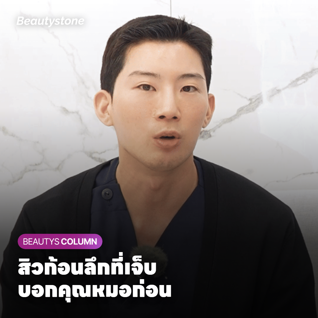 แพทย์ตรวจสิวก้อนลึกบริเวณกรามเพื่อประเมินความเสี่ยงแผลเป็น