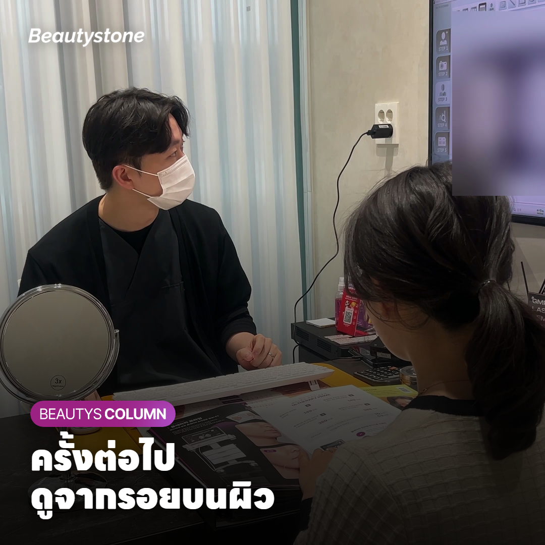 รูปถ่ายแผลเป็นจากสิวในแสงและมุมเดียวกันเรียงเปรียบเทียบตามวันที่