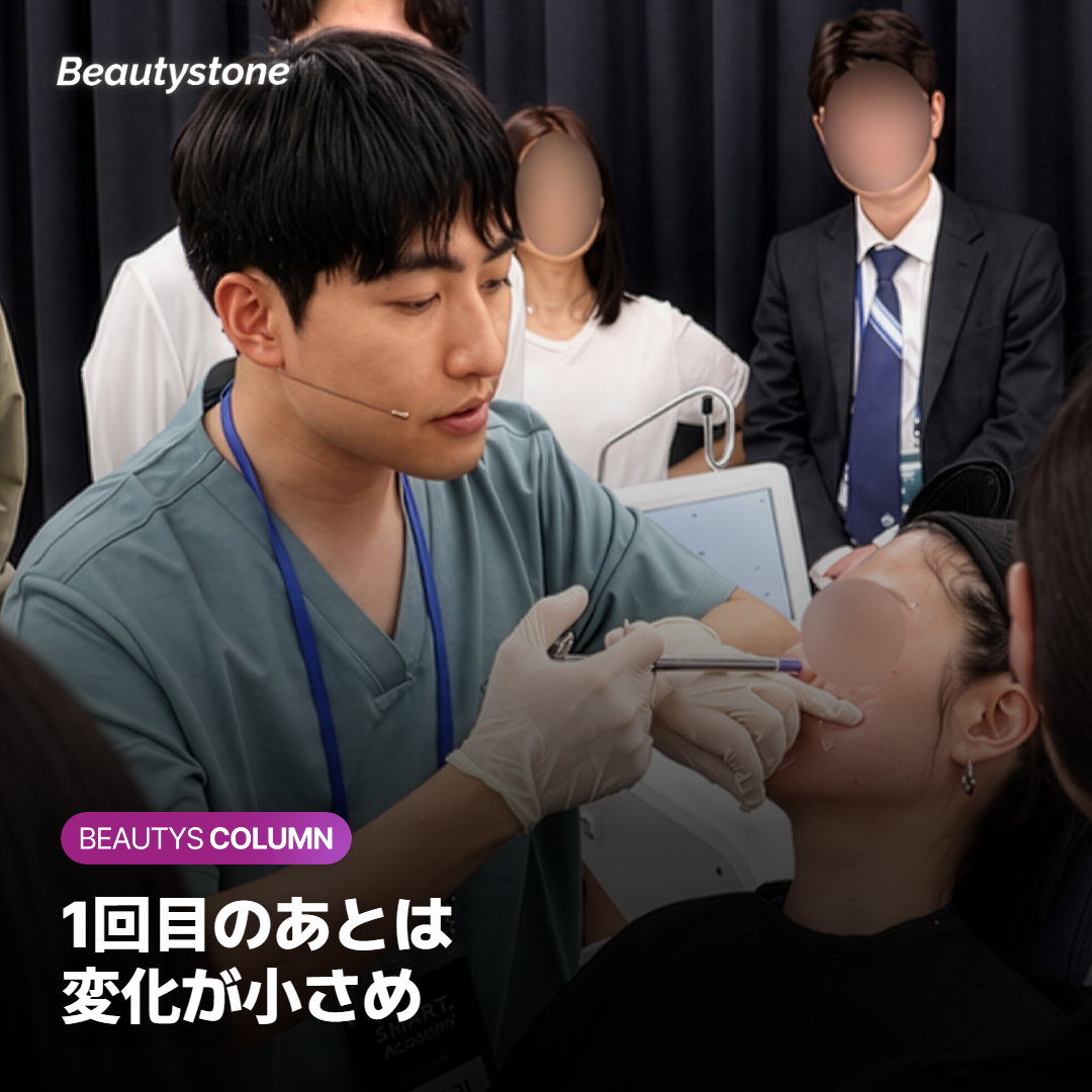 1回目のポテンツァのあと、鼻・額・頬で毛穴の改善の割合を比べたグラフのイメージ