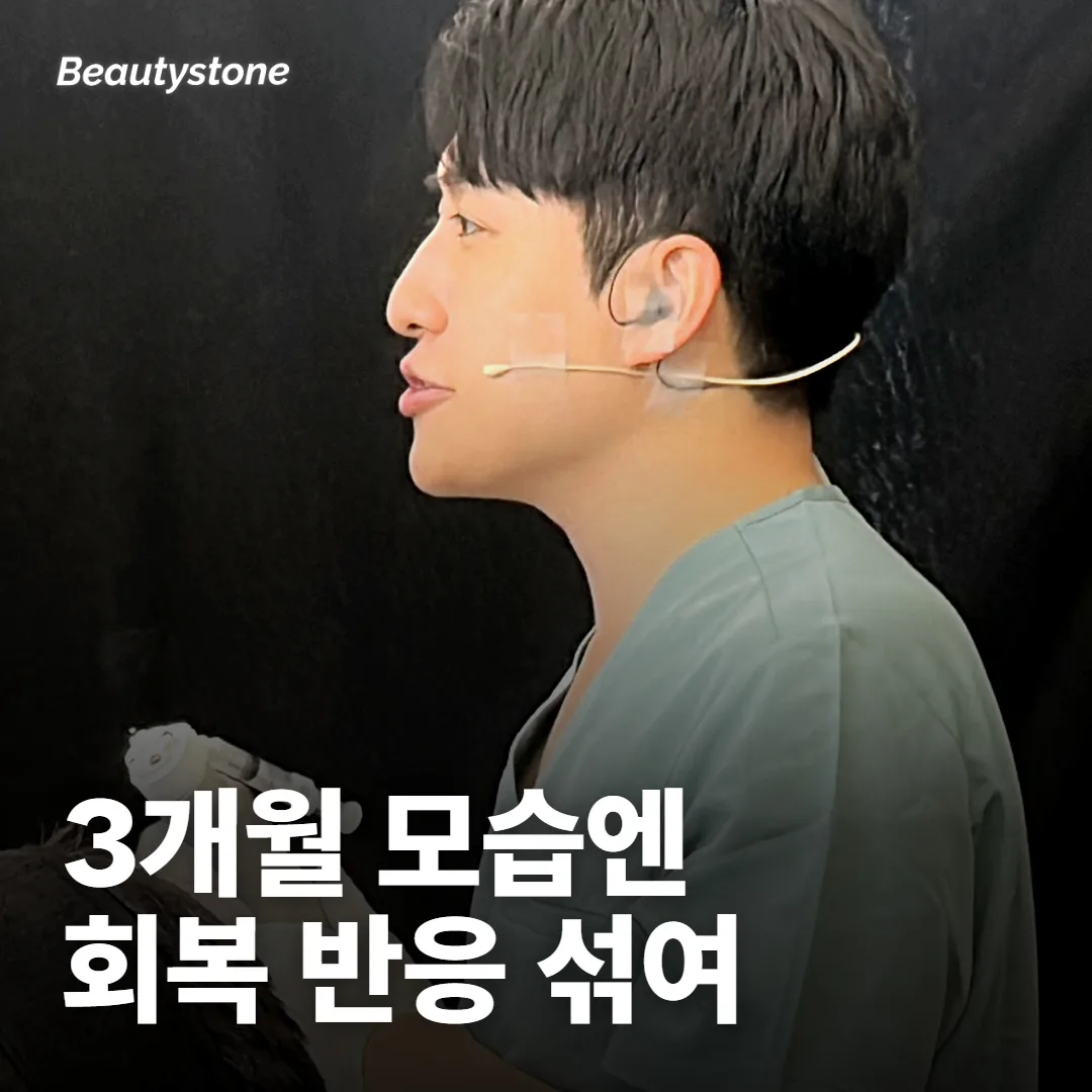 3개월 무렵보다 1~2년 뒤에 덜 좋아 보이는 건 왜 그런가요?
