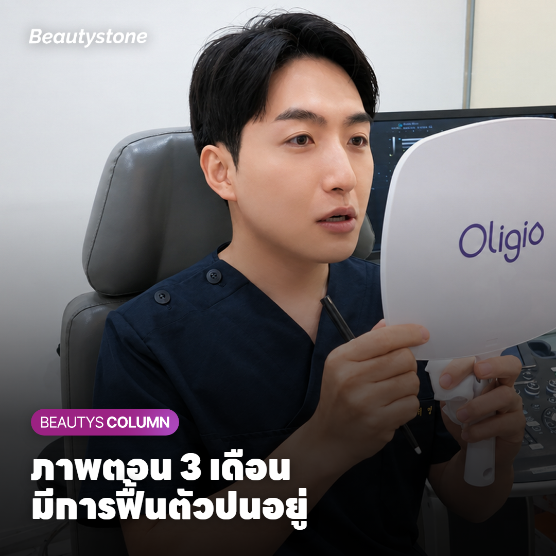 ผิวแก้มที่ยังมีรอยแดงจางๆ ในช่วงไม่กี่เดือนหลังทำเลเซอร์