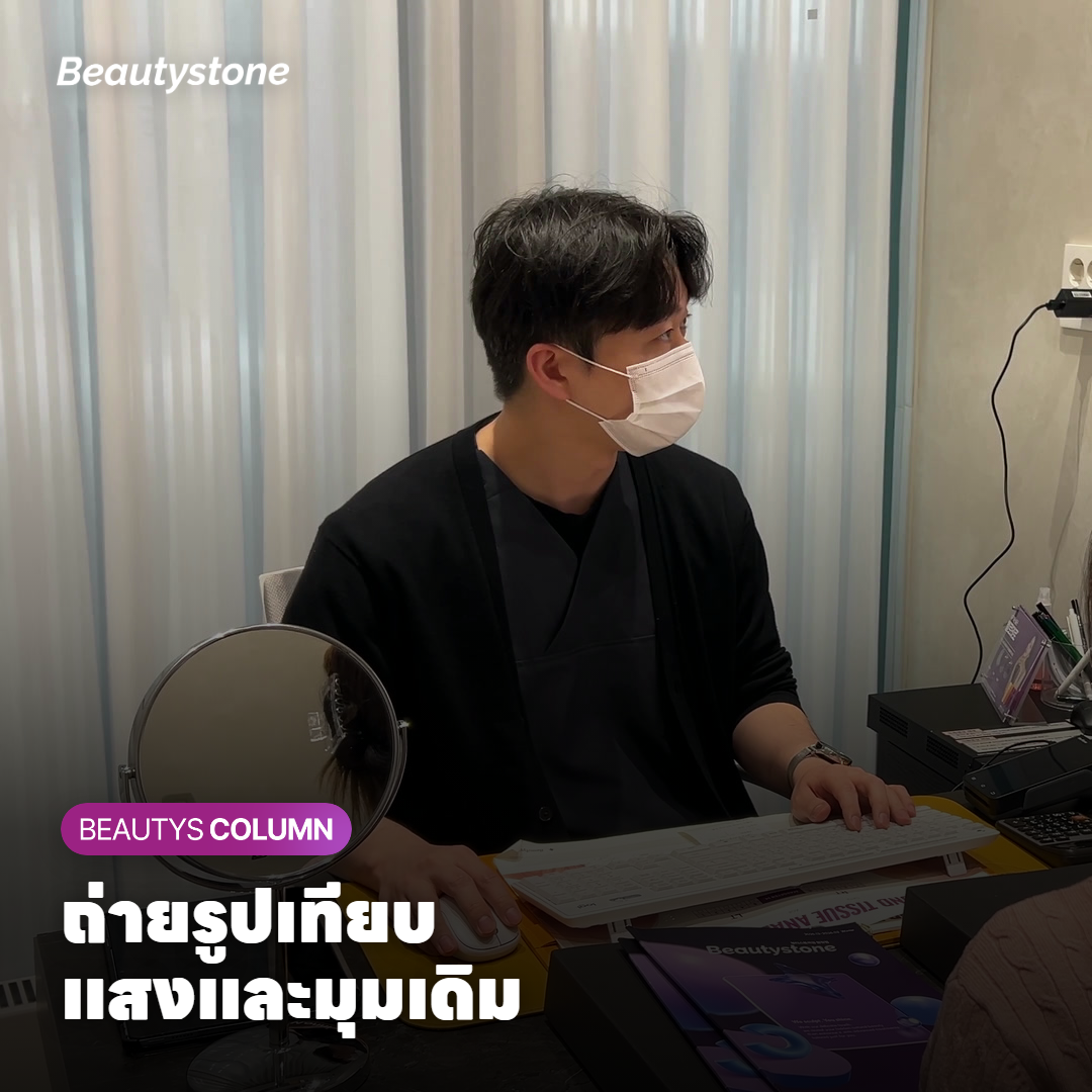 การถ่ายรูปหน้าตรงข้างหน้าต่างเพื่อเทียบความลึกของหลุมสิว
