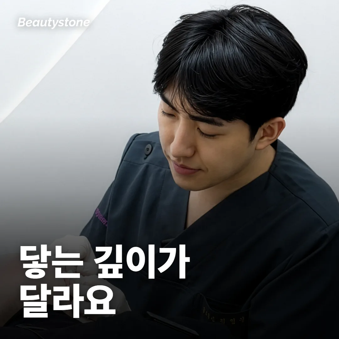 필링이랑 시크릿RF, 피부 어디까지 닿는 시술이에요?