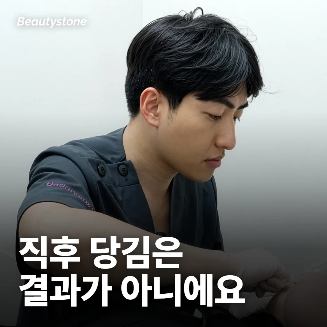 시술 직후 당겨진 느낌, 그게 효과인가요?