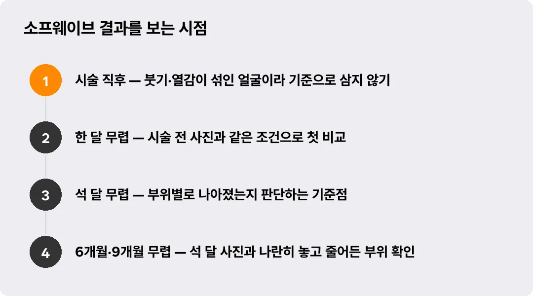 소프웨이브 결과를 보는 시점