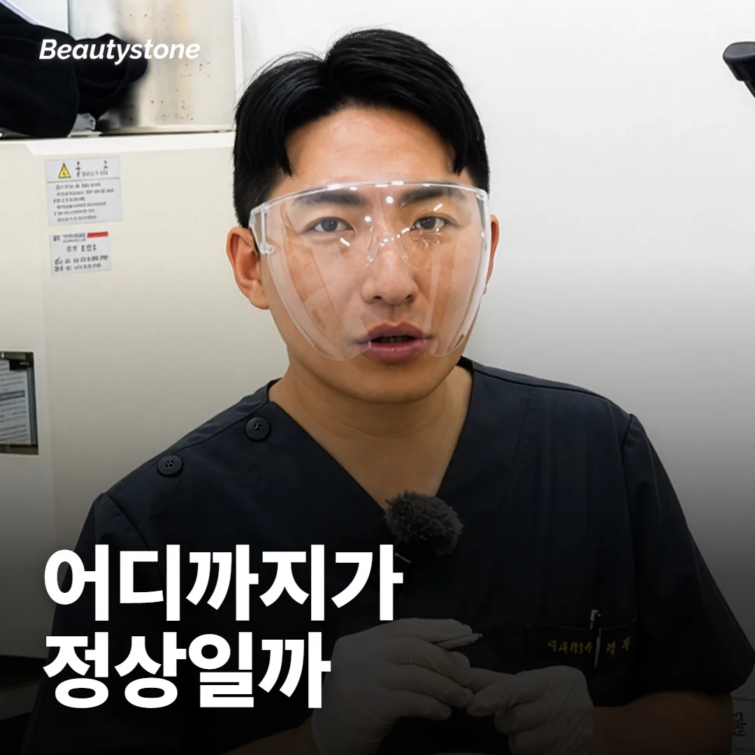 스킨부스터 부작용, 어디까지가 정상이에요?