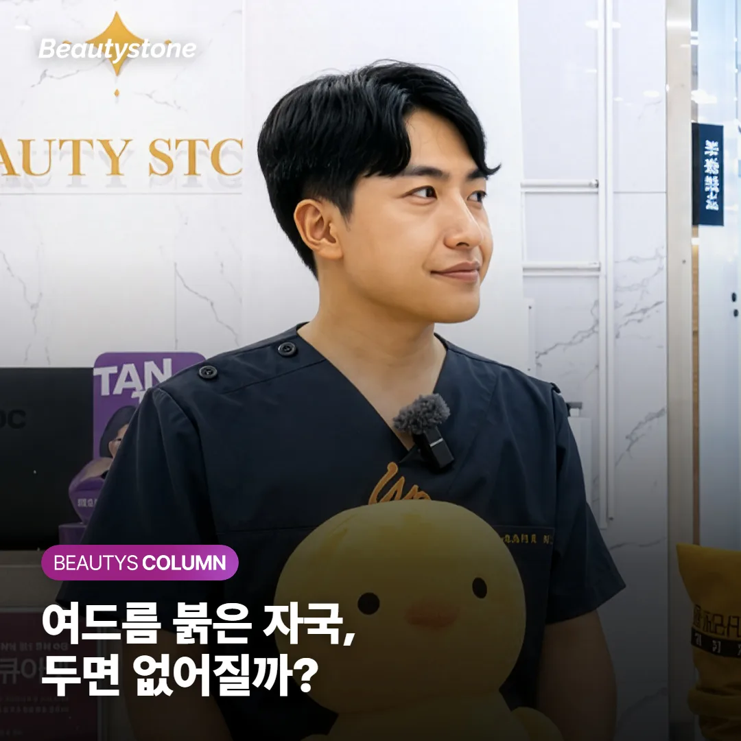 여드름 붉은 자국, 그냥 두면 없어질까? 기다릴 자국과 치료할 흉터