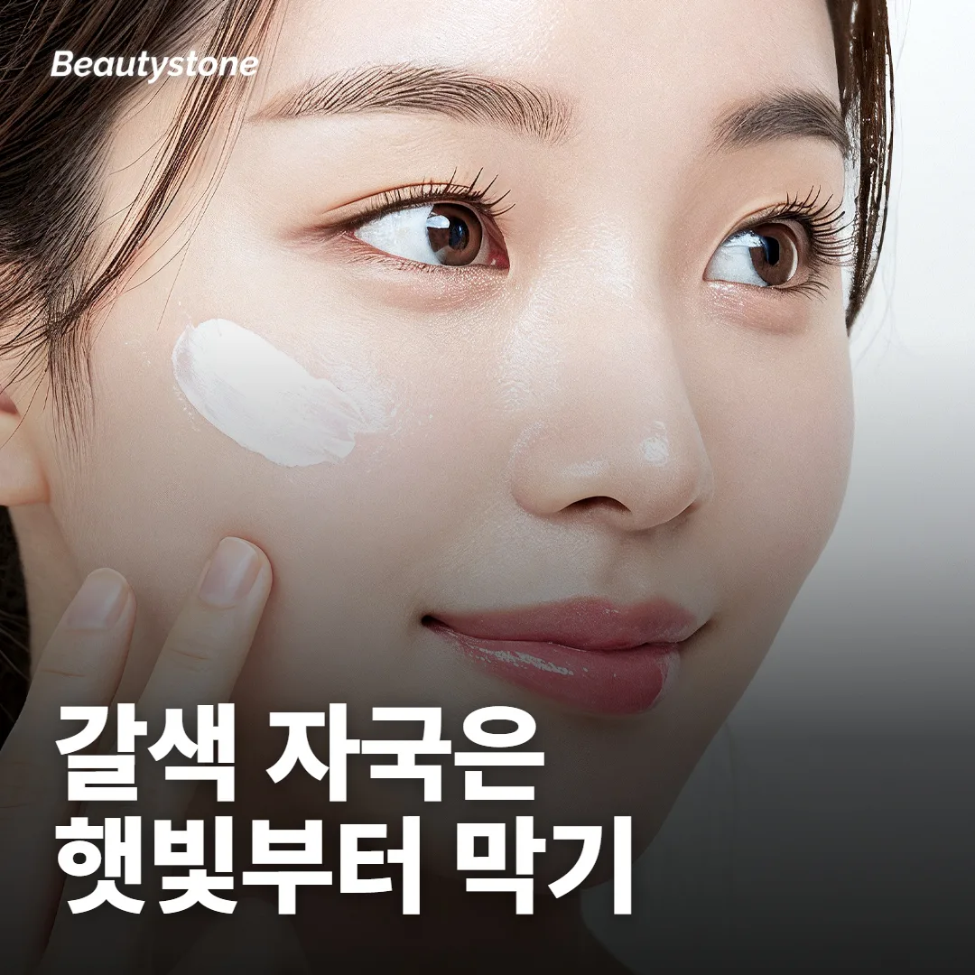 여드름 갈색 자국은 왜 여름에 더 진해져요?