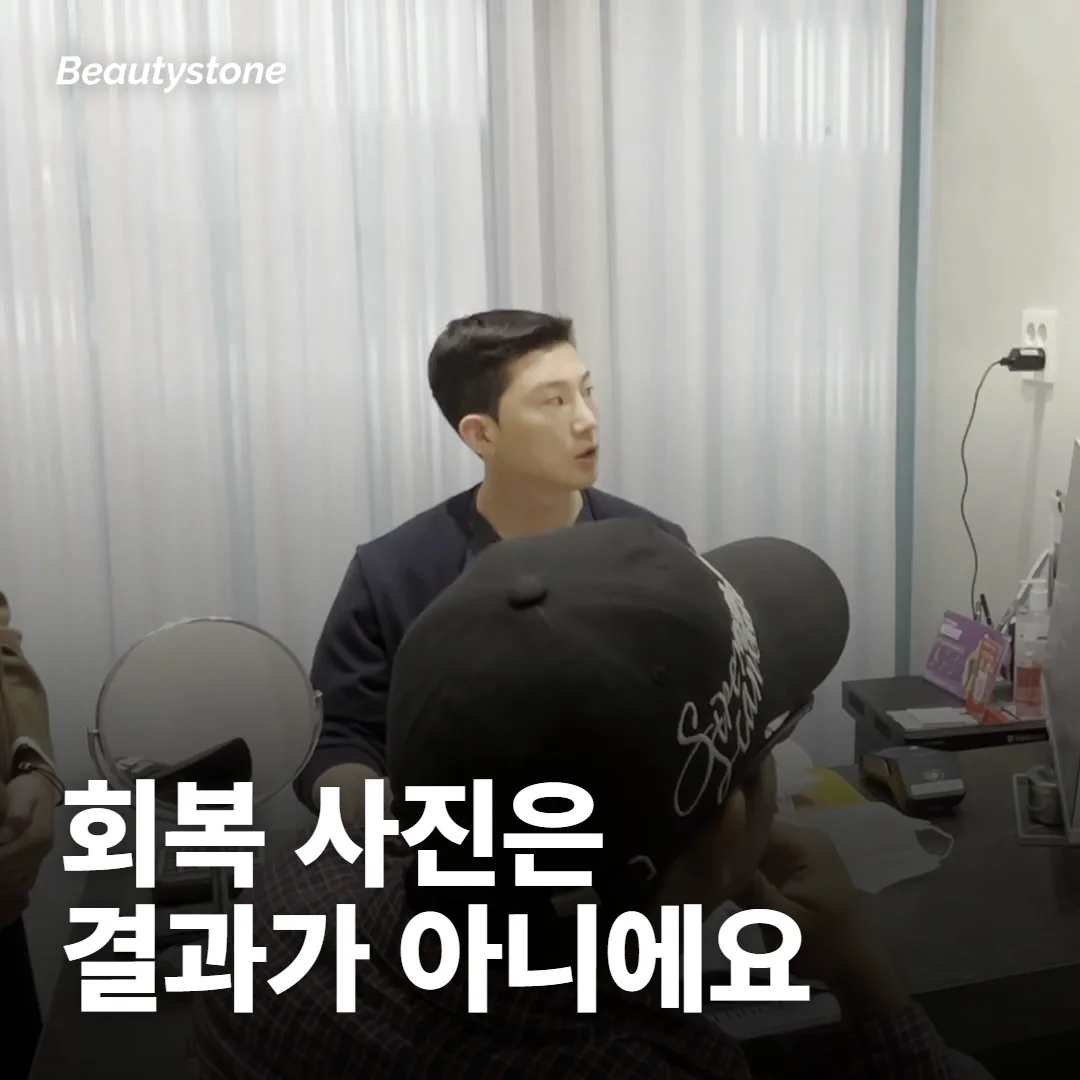 소프웨이브 전후, 사진은 언제 비교해야 해요?