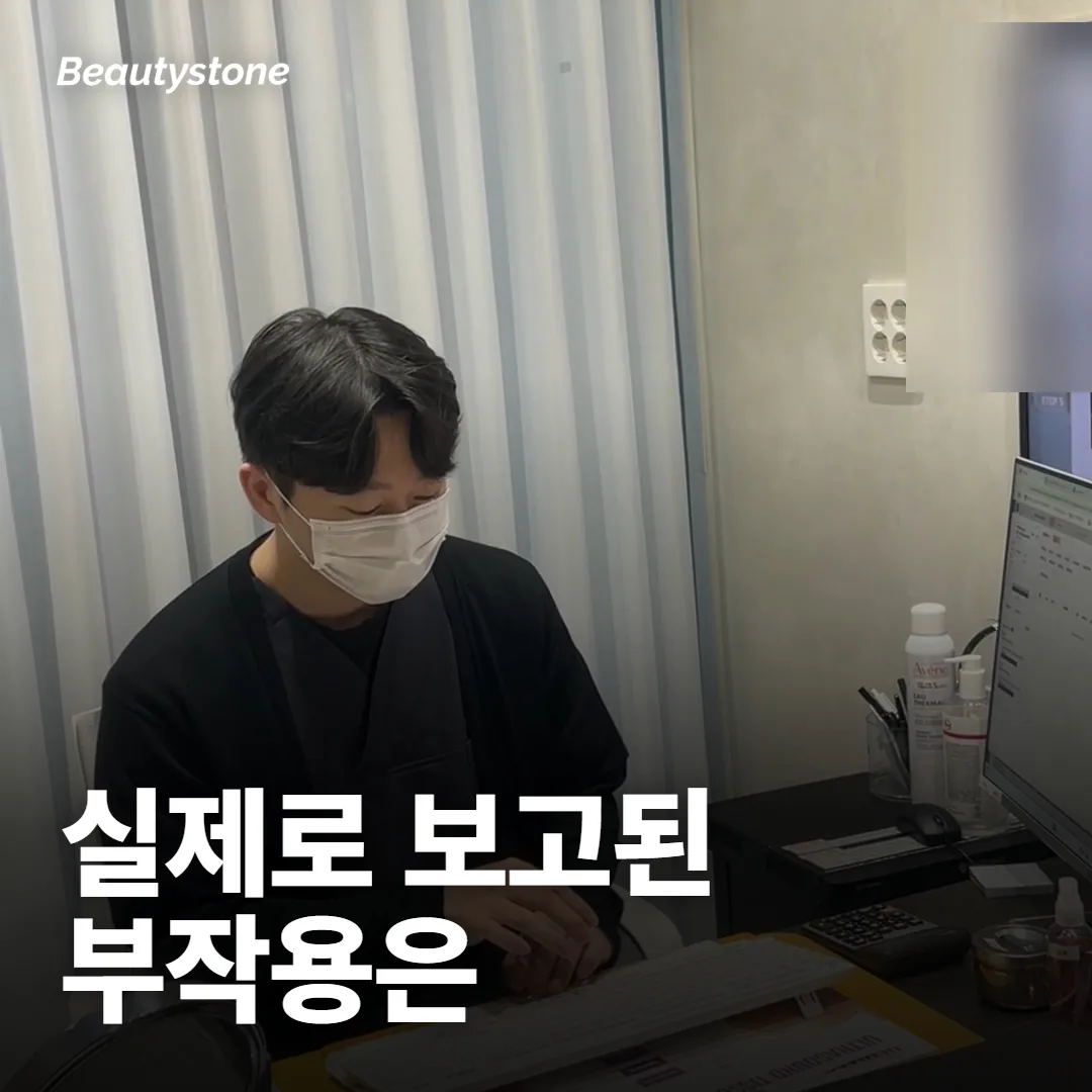 시크릿RF 부작용, 실제로 어떤 게 보고됐어요?