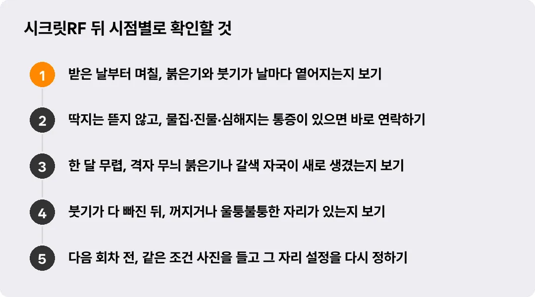 시크릿RF 뒤 시점별로 확인할 것