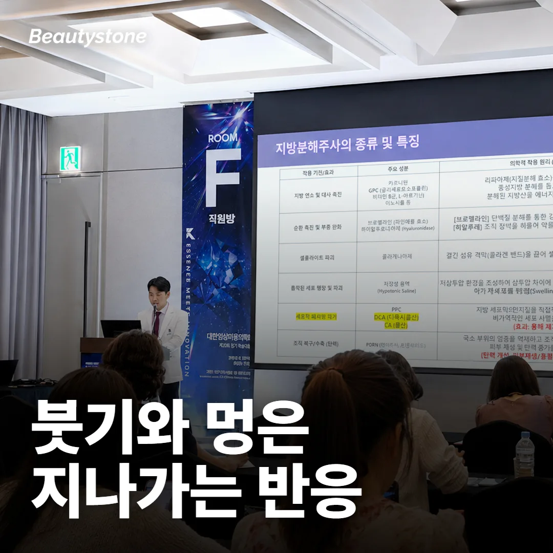 쥬베룩 볼륨 뒤 붓기·멍은 언제까지 괜찮나요?