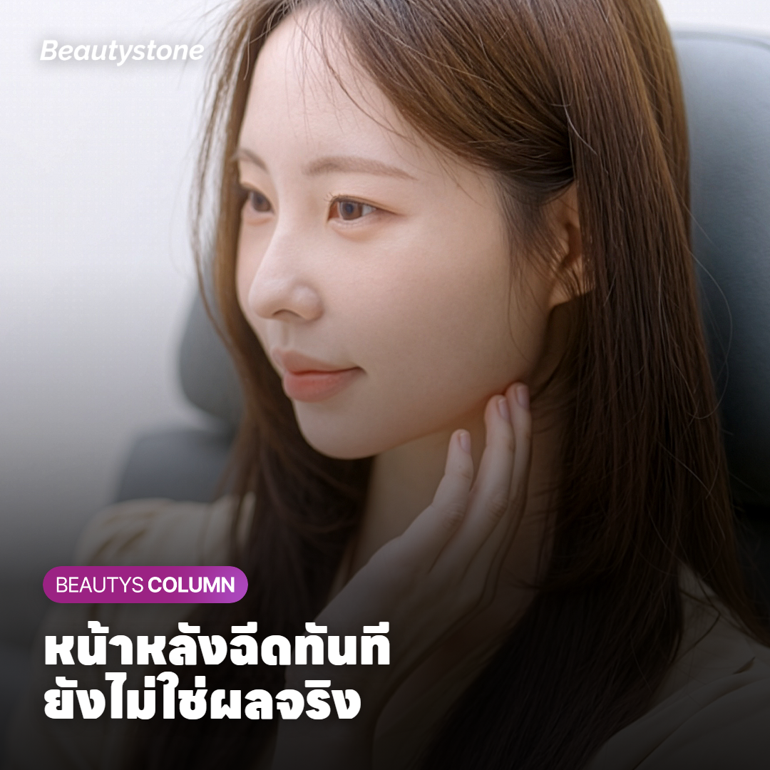 ทำไมดูหน้าหลังฉีดทันที แล้วเดาผลของ 3 ครั้งได้ยาก