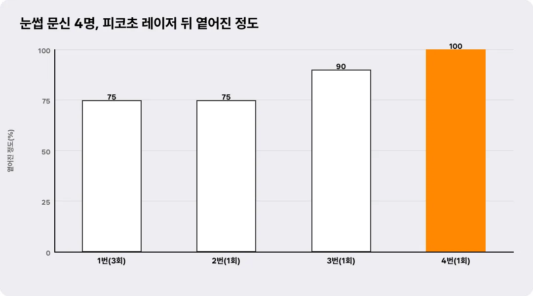 눈썹 문신 4명, 피코초 레이저 뒤 옅어진 정도